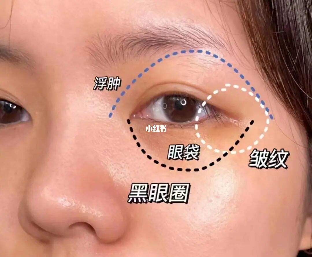 眼部皮肤护理，眼部皮肤护理步骤